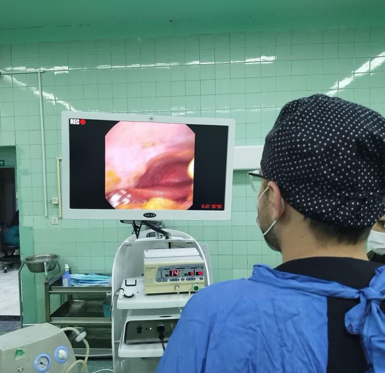  بیمارستان ولیعصر (عج) رزن از انجام موفقیت آمیز اولین عمل جراحی کله سیستکتومی به روش لاپاراسکوپی در این بیمارستان  خبر داد.